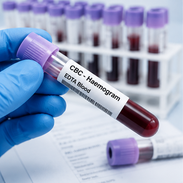 CBC Haemogram, EDTA Blood